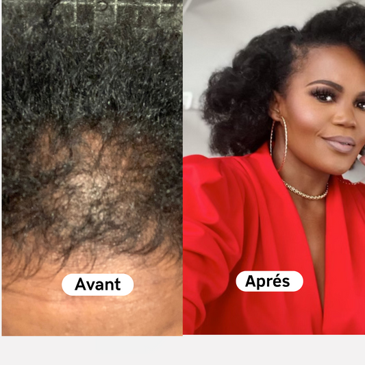 Pack Accélérateur de pousse de cheveux express 3 mois de cure